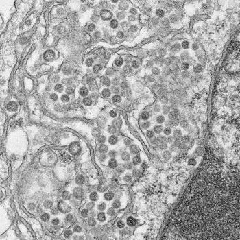 An electron micrograph of a thin section of MERS-CoV.